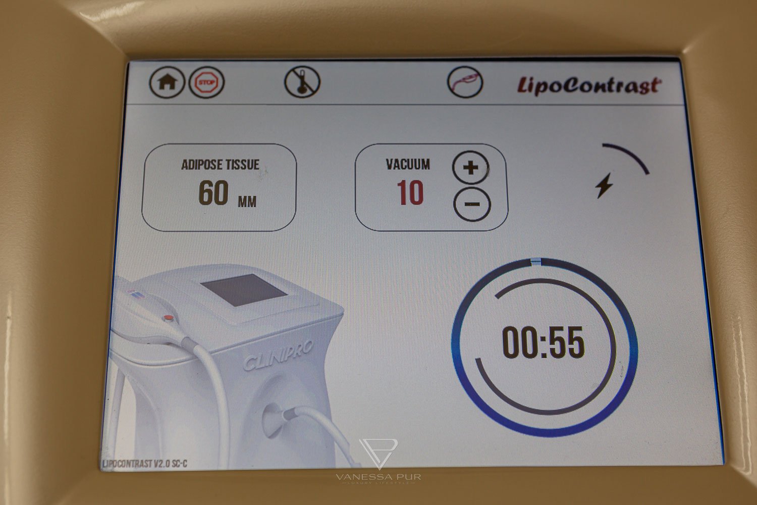 Cryolipolysis experience - reduce fat cells with cold 1 Cryolipolysis experience - reduce fat cells with cold - Fat reduction with cold - Long-term experience Long-term test - How are the experiences, hips, legs, abdomen, buttocks