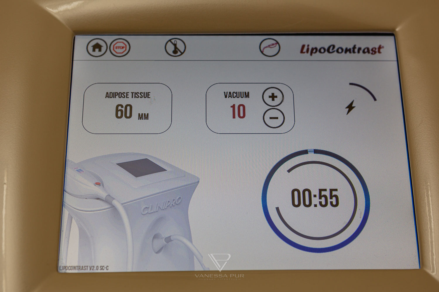 Cryolipolysis experience - reduce fat cells with cold - Fat reduction with cold - Long-term experience Long-term test - How are the experiences, hips, legs, abdomen, buttocks