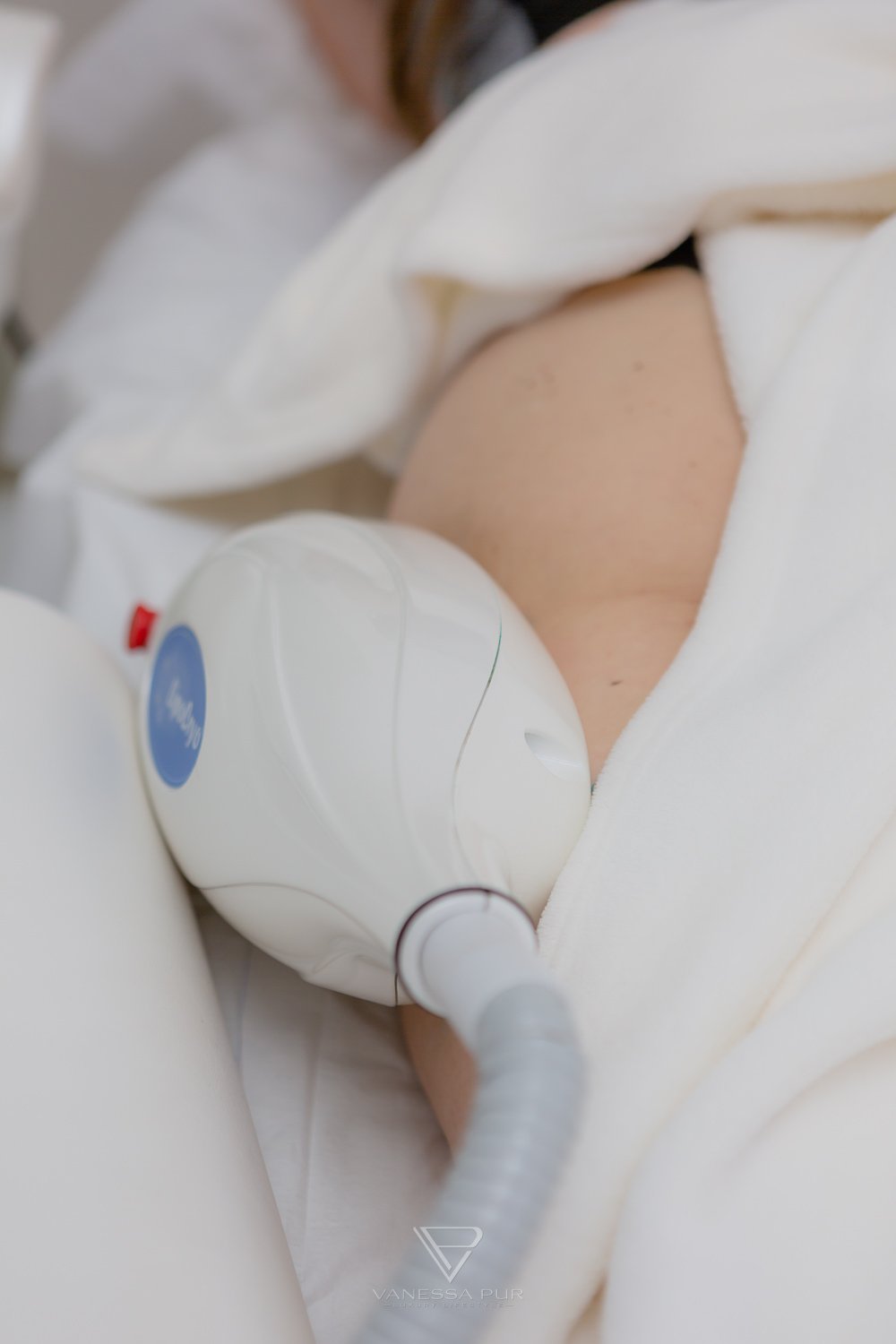Cryolipolysis experience - reduce fat cells with cold 2 Cryolipolysis experience - reduce fat cells with cold - Fat reduction with cold - Long-term experience Long-term test - How are the experiences, hips, legs, abdomen, buttocks