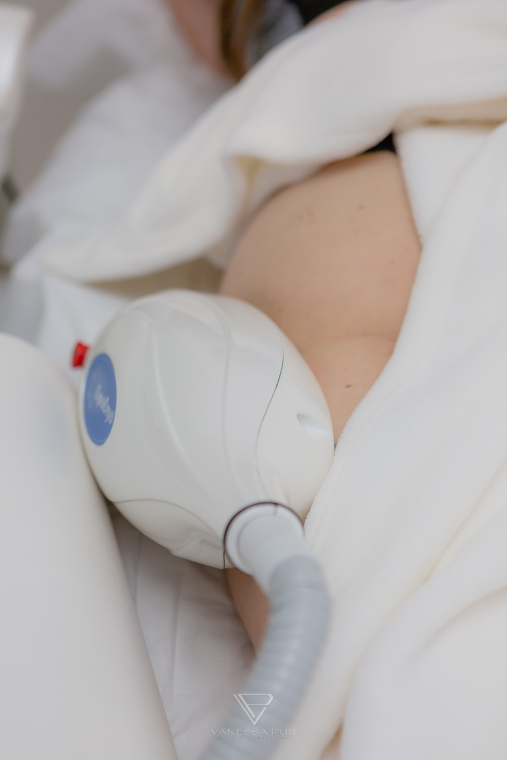 Cryolipolysis experience - reduce fat cells with cold - Fat reduction with cold - Long-term experience Long-term test - How are the experiences, hips, legs, abdomen, buttocks